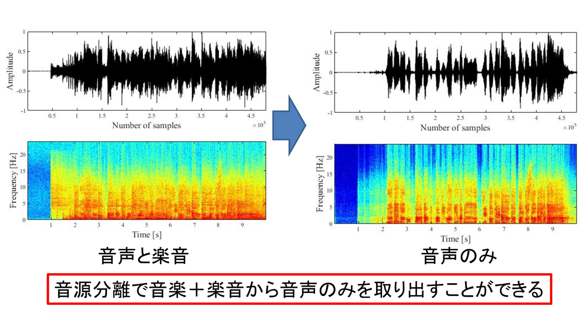 音声と音楽の音源分離技術